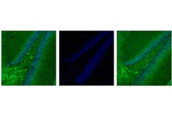 Cell Signaling Technology&nbsp;Phospho-Tau Thr205 E7D3E R