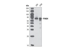 Cell Signaling Technology&nbsp;PIAS4 D2F12 Rabbit mAb 20 ul
