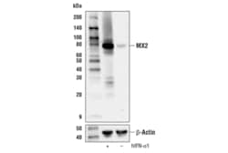 Cell Signaling Technology&nbsp;MX2 E7Y8H Rabbit mAb 100 ul
