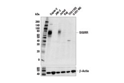 Cell Signaling Technology&nbsp;SIGIRR E4D6W Rabbit mAb 100