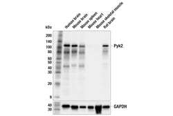 Cell Signaling Technology&nbsp;Pyk2 F3I2K Rabbit mAb 100 ul