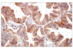 Cell Signaling Technology DHFR E6L1H Rabbit mAb 100 ul