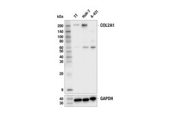 Cell Signaling Technology&nbsp;COL2A1 E8S2S Rabbit mAb 100