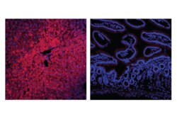 Cell Signaling Technology&nbsp;Arginase-1 D4E3Mtm XPR R