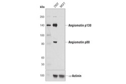Cell Signaling Technology&nbsp;Angiomotin D2O4H Rabbit mAb
