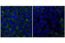 Cell Signaling Technology&nbsp;YTHDF1 E8R5L Rabbit mAb 100