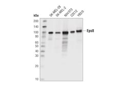 Cell Signaling Technology Eps8 D1X1L Rabbit mAb 100 ul