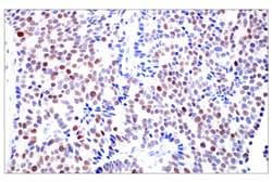 Cell Signaling Technology C/EBP-beta E2K1U Rabbit mAb