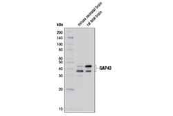 Cell Signaling Technology&nbsp;GAP43 D9C8 Rabbit mAb BSA a