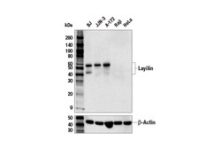 Cell Signaling Technology&nbsp;Layilin E9U6M Rabbit mAb 100
