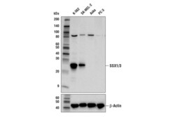 Cell Signaling Technology SSX1/3 E9P5M Rabbit mAb Ami