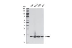 Cell Signaling Technology&nbsp;SOD1 71G8 Mouse mAb 20 ul