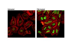 Cell Signaling Technology&nbsp;Acetyl-Histone H3 Lys36 D9T