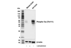 Cell Signaling Technology&nbsp;Phospho-Tau Thr111 Antibody