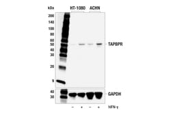 Cell Signaling Technology&nbsp;TAPBPR E5P1F Rabbit mAb 100