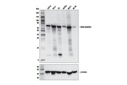 Cell Signaling Technology RPA70/RPA1 E7T4Y Rabbit mAb