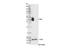 Cell Signaling Technology HDGF E3P7K Rabbit mAb 100 ul