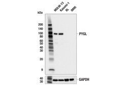 Cell Signaling Technology&nbsp;PYGL E4O1P Rabbit mAb 100 ul