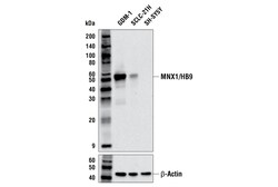 Cell Signaling Technology&nbsp;MNX1/HB9 E3W8D Rabbit mAb 10