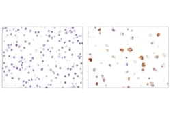 Cell Signaling Technology&nbsp;SignalSlideR Mouse PD-L1 IHC