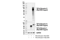 Cell Signaling Technology&nbsp;TGF-beta Receptor II E5M6F R