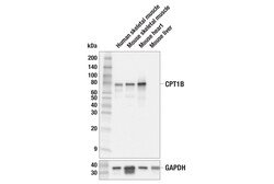 Cell Signaling Technology&nbsp;CPT1B E6M5M Rabbit mAb 100 u