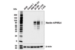 Cell Signaling Technology Nectin-4/PVRL4 E5Q1W Rabbit