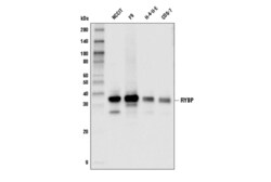 Cell Signaling Technology RYBP D8J7W Rabbit mAb 100 ul