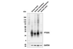 Cell Signaling Technology&nbsp;PTGDS F5R5O Rabbit mAb 100 u