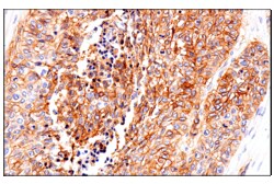 Cell Signaling Technology&nbsp;p75NTR E7I3M Rabbit mAb 100
