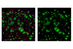 Cell Signaling Technology&nbsp;beta-Amyloid Mouse Model Neuro