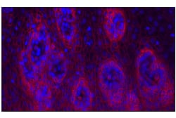 Cell Signaling Technology&nbsp;CD141/Thrombomodulin E7Y9P X