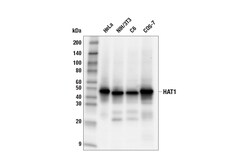 Cell Signaling Technology HAT1 E7Y8Q Rabbit mAb 100 ul
