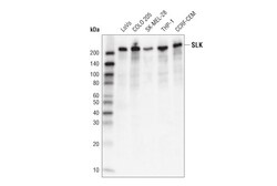 Cell Signaling Technology&nbsp;SLK Antibody 100 ul