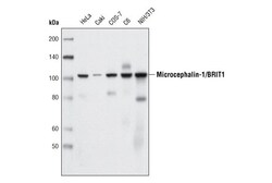 Cell Signaling Technology&nbsp;Microcephalin-1/BRIT1 D38G5