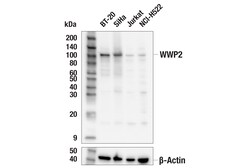 Cell Signaling Technology&nbsp;WWP2 E8W8A Rabbit mAb 100 ul