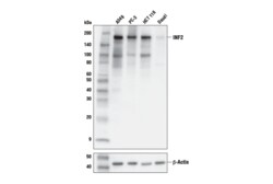 Cell Signaling Technology INF2 E7H5D Rabbit mAb 100 ul
