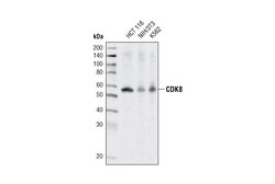Cell Signaling Technology&nbsp;CDK8 P455 Antibody 20 ul