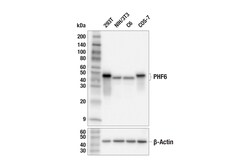 Cell Signaling Technology&nbsp;PHF6 E8F2L Rabbit mAb 100 ul