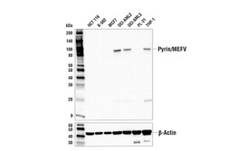 Cell Signaling Technology Pyrin/MEFV E2E8U Rabbit mAb