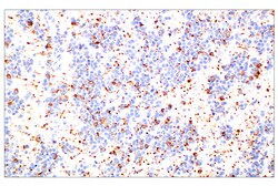 Cell Signaling Technology&nbsp;Doublecortin E3S7L Rabbit mA