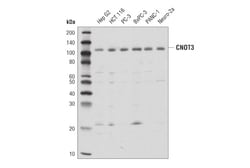 Cell Signaling Technology&nbsp;CNOT3 D4K4N Rabbit mAb 100 u
