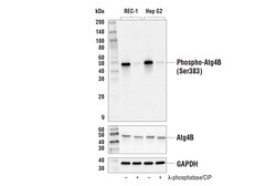 Cell Signaling Technology&nbsp;Phospho-Atg4B Ser383 E3I8M