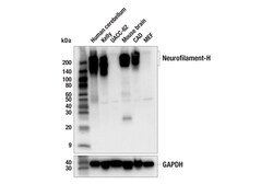 Cell Signaling Technology&nbsp;Neurofilament-H E3O6W Mouse