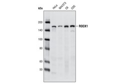 Cell Signaling Technology&nbsp;ROCK1 C8F7 Rabbit mAb 20 ul