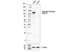 Cell Signaling Technology&nbsp;Androgen Receptor D6F11 XPR