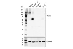 Cell Signaling Technology&nbsp;PLVAP Antibody Carboxy-termin