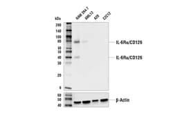 Cell Signaling Technology&nbsp;IL-6R-alpha/CD126 E7H4J Rabb