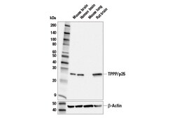 Cell Signaling Technology&nbsp;TPPP/p25 Antibody 100 ul
