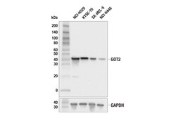 Cell Signaling Technology&nbsp;GOT2 F4P3R Rabbit mAb 100 ul